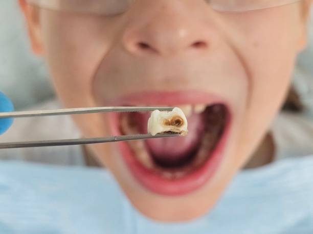 Best Emergency Pediatric Dental Care in Mendota, IL